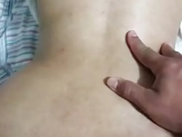 Na prolapse anal muasi, libolo ya muasi.